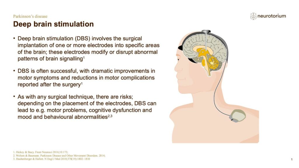 Deep brain stimulation